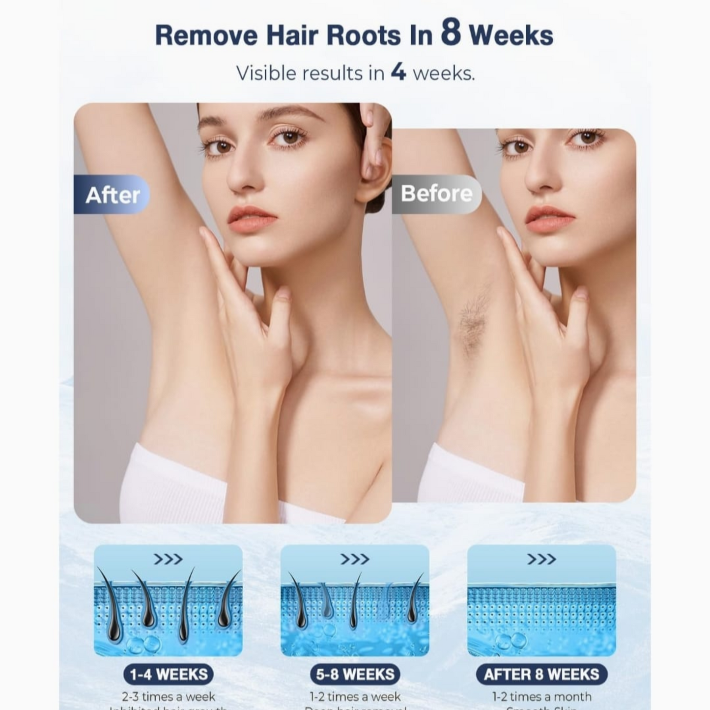 DEPILADORA LÁSER IPL VIVAEASE +  GEL CONDUCTOR GRATIS