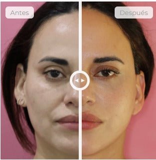 ⚡ MICROCORRIENTE CON EFECTO LIFTING